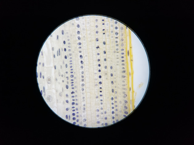 Onion Root Mitosis Slides - Onion Root  Mitosis  03 400X